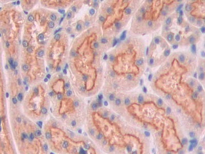 Cubilin (CUBN) Rat Polyclonal Antibody