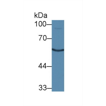 Calcitonin Receptor (CTR) Mouse Polyclonal Antibody