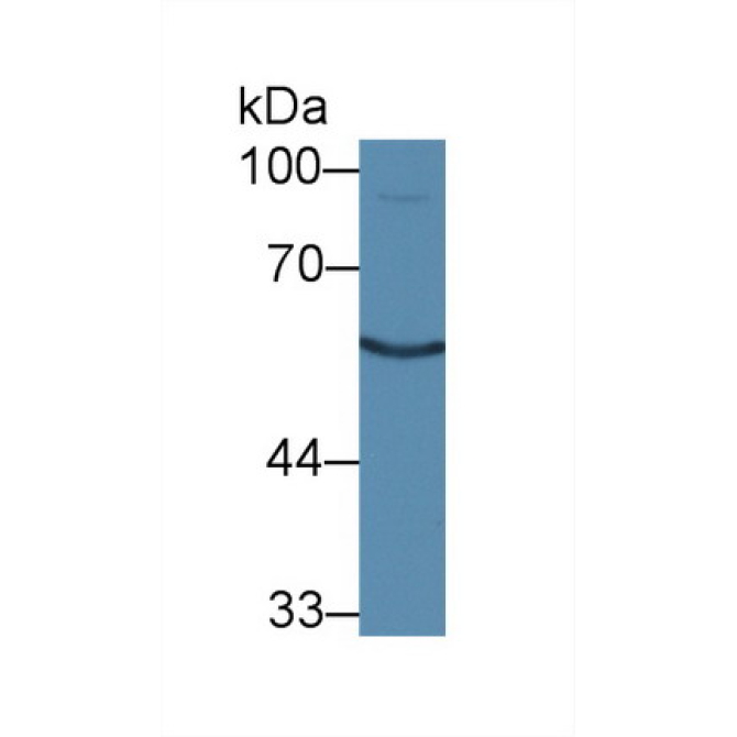 Calcitonin Receptor (CTR) Mouse Polyclonal Antibody