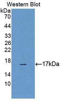 Calcitonin Receptor (CTR) Rat Polyclonal Antibody