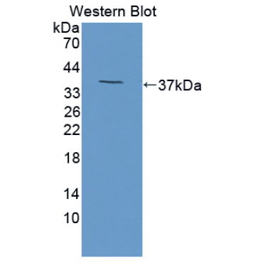 Calcium Sensing Receptor (CASR) Mouse Polyclonal Antibody