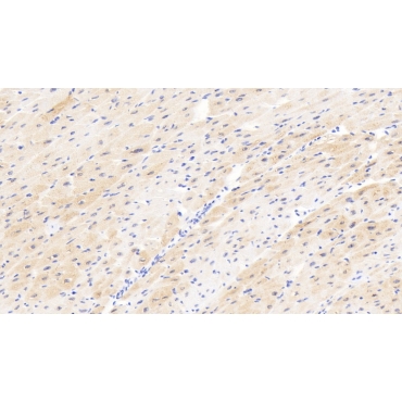 Carnitine Palmitoyltransferase 2, Mitochondrial (CPT2) Human Polyclonal Antibody