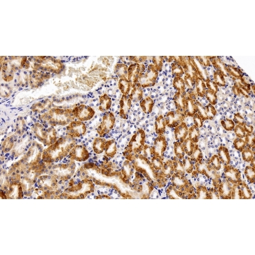 Catalase (CAT) Human Polyclonal Antibody