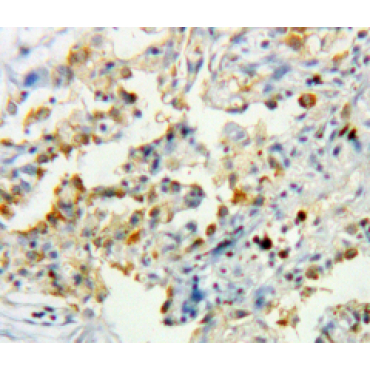 Catalase (CAT) Human Polyclonal Antibody