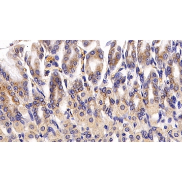 Catalase (CAT) Human Polyclonal Antibody