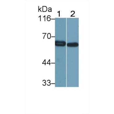 Catalase (CAT) Human Polyclonal Antibody