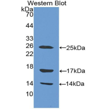 Cathelicidin Antimicrobial Peptide (CAMP) Human Polyclonal Antibody