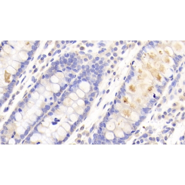 Chimerin 2 (CHN2) Human Polyclonal Antibody
