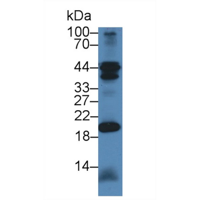 Chimerin 2 (CHN2) Mouse Polyclonal Antibody