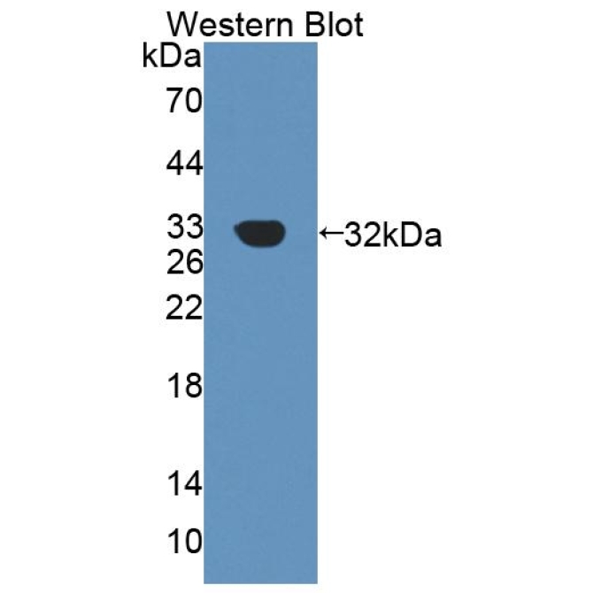 Constitutive Androstane Receptor (CAR) Mouse Polyclonal Antibody