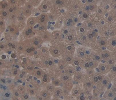 Constitutive Androstane Receptor (CAR) Rat Polyclonal Antibody