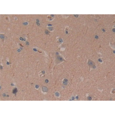 Cylindromatosis (CYLD) Human Polyclonal Antibody