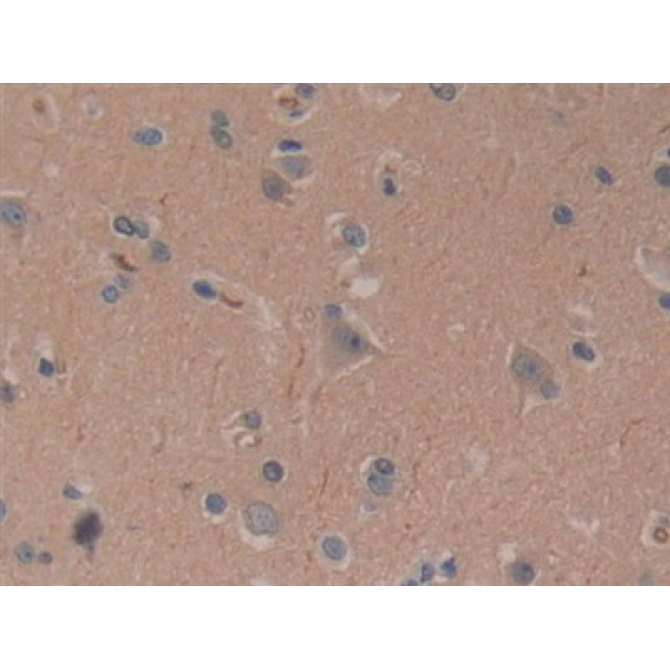 Cylindromatosis (CYLD) Human Polyclonal Antibody