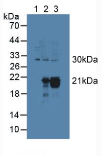 Cytoglobin (CYGB) Rat Polyclonal Antibody