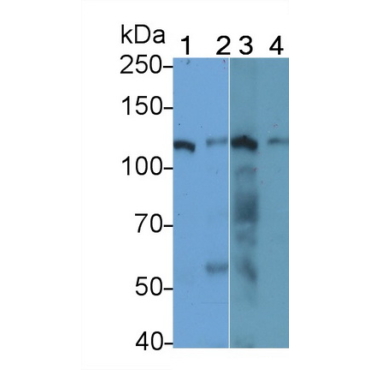 Dishevelled Associated Activator Of Morphogenesis 1 (DAAM1) Human Polyclonal Antibody