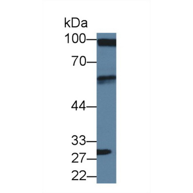 Drebrin 1 (DBN1) Human Polyclonal Antibody