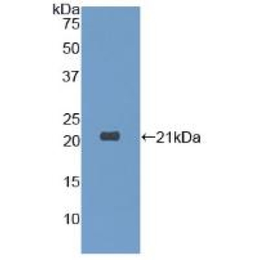 Dermatopontin (DPT) Human Polyclonal Antibody