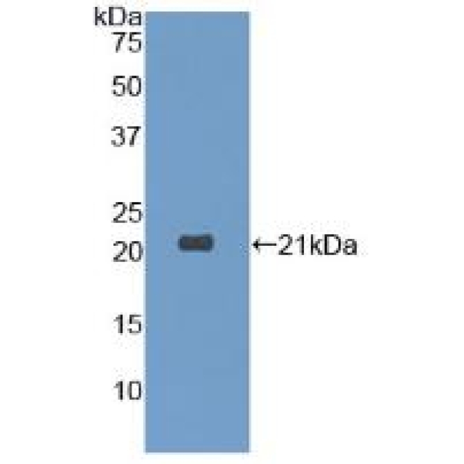 Dermatopontin (DPT) Human Polyclonal Antibody