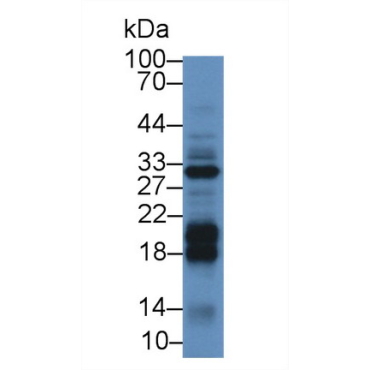 Diacylglycerol Kinase Alpha (DGKa) Mouse Polyclonal Antibody