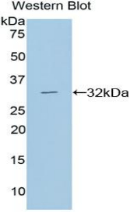 Diacylglycerol Kinase Alpha (DGKa) Rat Polyclonal Antibody