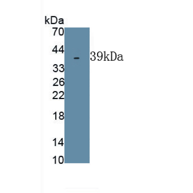 Dentin Sialophosphoprotein (DSPP) Human Polyclonal Antibody