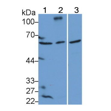 Dymeclin (DYM) Human Polyclonal Antibody