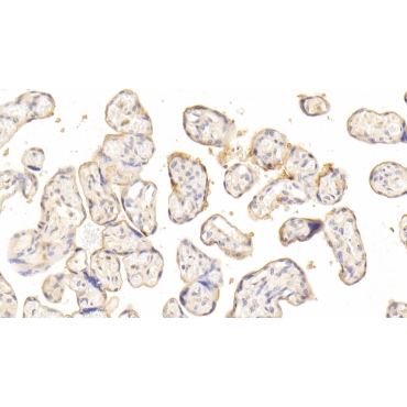 Dysferlin (DYSF) Human Polyclonal Antibody