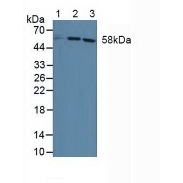 Dyskerin (DKC) Human Polyclonal Antibody