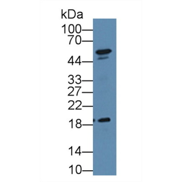 Dyskerin (DKC) Mouse Polyclonal Antibody