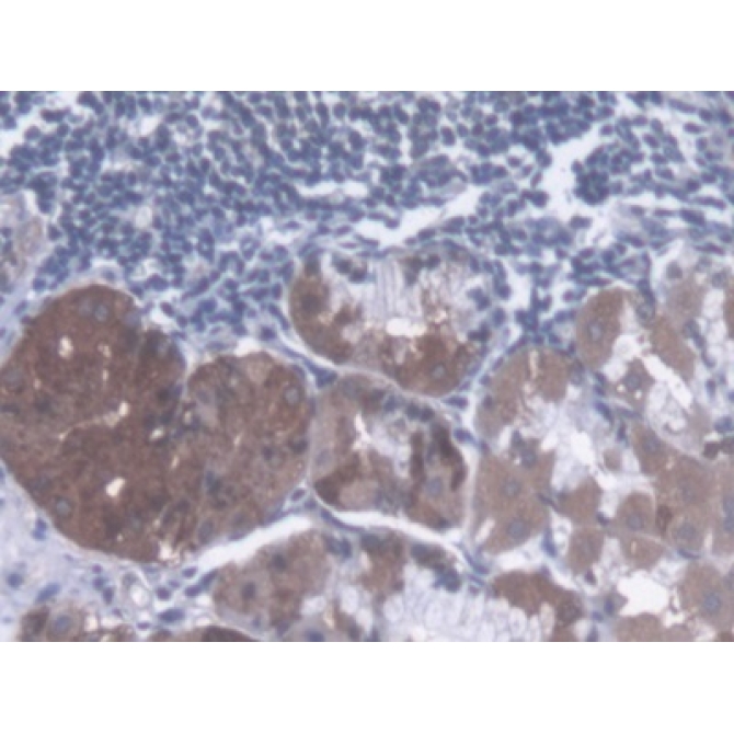 Dystonin (DST) Human Polyclonal Antibody