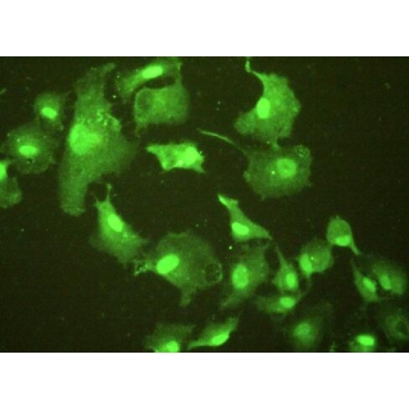 Epithelial Cell Transforming Sequence 2 (ECT2) Human Polyclonal Antibody