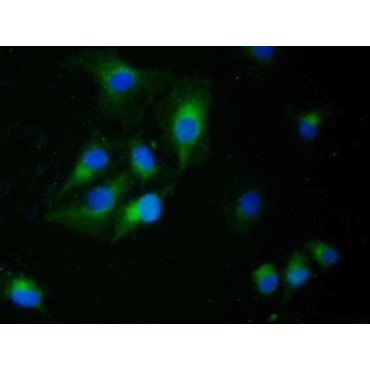Epithelial Cell Transforming Sequence 2 (ECT2) Human Polyclonal Antibody