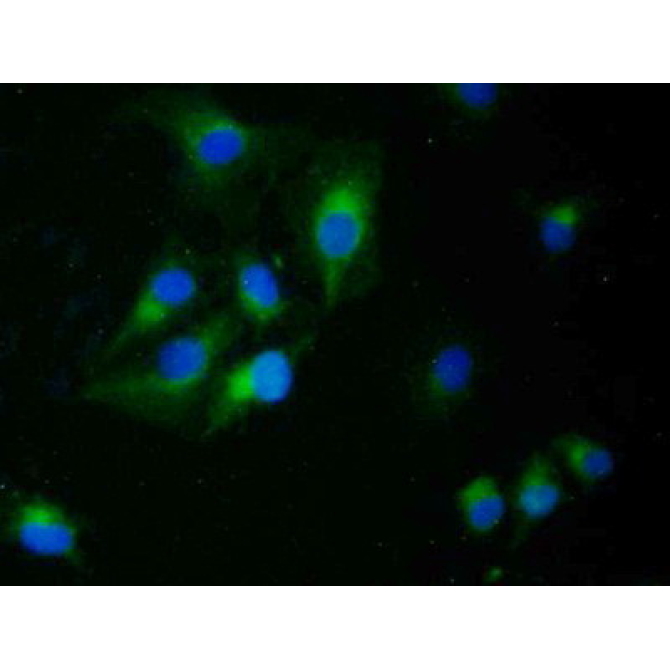 Epithelial Cell Transforming Sequence 2 (ECT2) Human Polyclonal Antibody