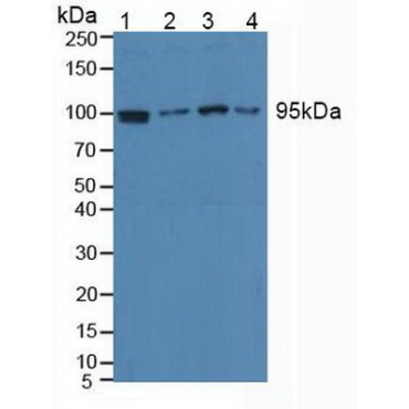 Eukaryotic Translation Elongation Factor 2 (EEF2) Human Polyclonal Antibody