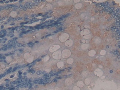 Endonuclease G, Mitochondrial (ENDOG) Rat Polyclonal Antibody