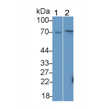 Cytosolic Ovarian Carcinoma Antigen 1 (COVA1) Human Polyclonal Antibody