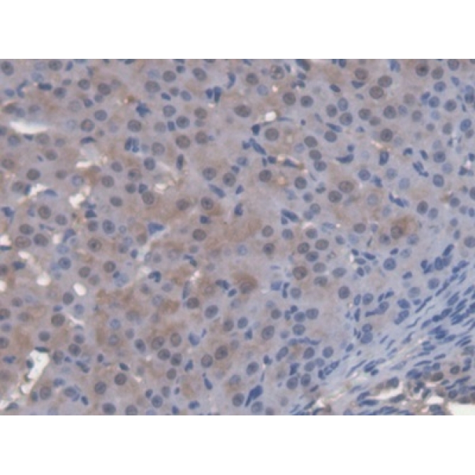 Cytosolic Ovarian Carcinoma Antigen 1 (COVA1) Mouse Polyclonal Antibody
