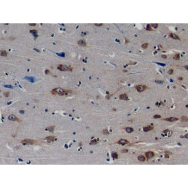 Nucleus Signalling 1 (ERN1) Human Polyclonal Antibody