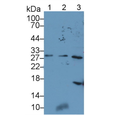 Endoplasmic Reticulum Protein 29 (ERP29) Human Polyclonal Antibody