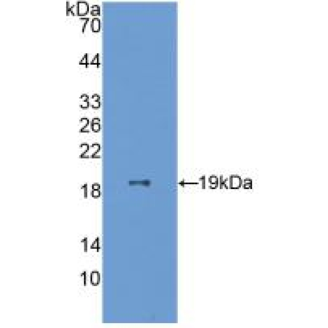 Endothelial Cell Specific Molecule 1 (ESM1) Human Polyclonal Antibody