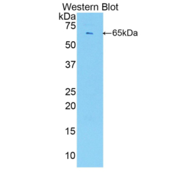 Endothelial Cell Specific Molecule 1 (ESM1) Mouse Polyclonal Antibody