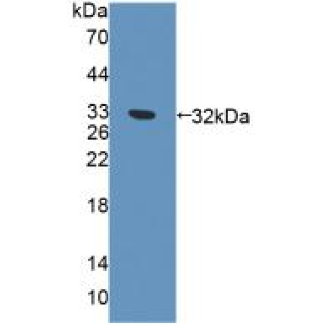 Exonuclease 1 (EXO1) Human Polyclonal Antibody