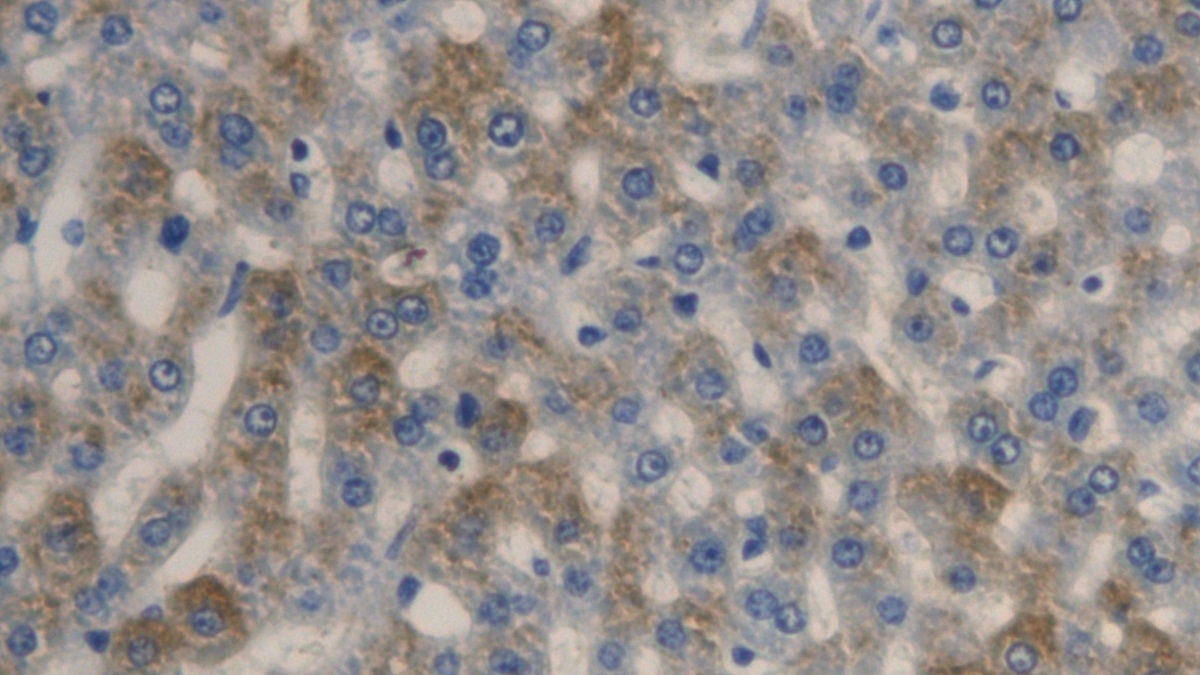 Fatty Acid Desaturase 1 (FADS1) Rat Polyclonal Antibody