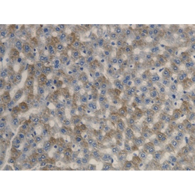 Fatty Acid Desaturase 1 (FADS1) Mouse Polyclonal Antibody