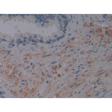 Fibroblast Activation Protein Alpha (FAPa) Human Polyclonal Antibody