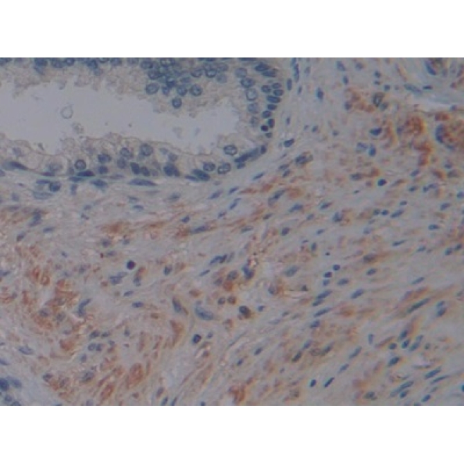Fibroblast Activation Protein Alpha (FAPa) Human Polyclonal Antibody