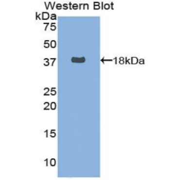 Fatty Acid Synthase (FASN) Human Polyclonal Antibody
