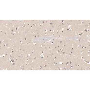 Fatty Acid Synthase (FASN) Human Polyclonal Antibody