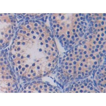 Fatty Acid Synthase (FASN) Mouse Polyclonal Antibody