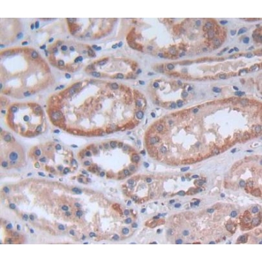 Fas Activated Serine/Threonine Kinase (FASTK) Human Polyclonal Antibody